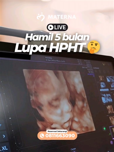 Cara Menentukan Usia Kehamilan Jika Lupa HPHT