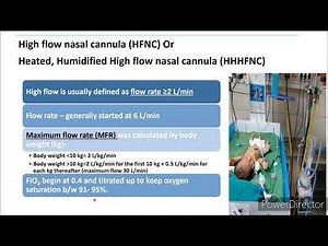 High Flow Nasal Cannula (HFNC) | Pediatrics
