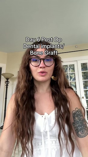 We made it to day 6!! Cant thank @Drjefflynch.dds enough for taking such good care if me and making sure that my healing process has gone so smoothly. I feel heard and understood. All of my questions, concerns and feelings have been acknowledged and im really thankful for that. #day6 #postopcare #dentalimplant #bonegrafting #healingjourney #update