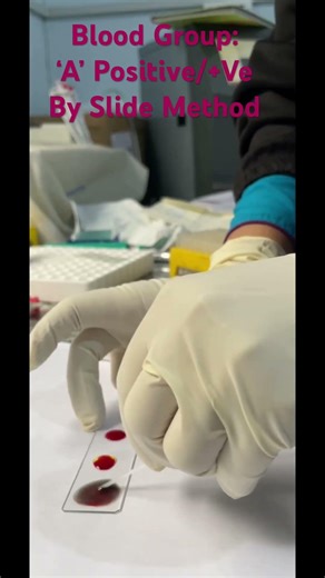 BLOOD GROUPING PROCEDURE BY SLIDE METHOD. #microscopicworld #laboratory #science #foryou 🔬