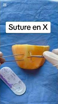 Suture en X "How to Perform the X-Stitch Suture | Surgical Technique Explained"