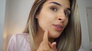 【北美美妝達人 Barbara 🎉真實感受👏】 其實她驚訝，我們也驚訝，沒想到她用後效果這麼好！ 當然，科學上有效是驗證的，但我們不愛誇張話術 雖然她兩週見效，但實際效果，還是因人而異啦!! 美白不易又費錢，所以不妨考慮 真科學有效➕30天無效退款的✨零風險選擇✨ ☀️3％ 酯化維他命C☀️ ⬇️⬇️⬇️ 👉👉https://bfc.cool/SFlP3 p.s.現在還有🔥限時特價349🔥 ☀️3％ 酯化維他命C☀️小知識 ✅ 適合混合乾肌/ 乾肌（質地細密） ✅ 親脂性，吸收度佳，美白效果更持久 ✅ 抑制黑色素形成，改善暗沈 ☑️ 衛福部唯一許可藥用美白成分 ☑️ 3%法定最高濃度 ☑️ 成分穩定不刺激 馬上了解👉👉https://bfc.cool/SFlP3 影片出處 🎥： [HOW TO GET RID OF ACNE SCARS] https://youtu.be/VJl6YPGBCpQ #沒有話術只有真相 #沒有奇蹟只有科學 #大牌四分之一價格的高CP值 #零風險體驗科學保養 #BareSkinScience | Bffect好肌膚精華研究室