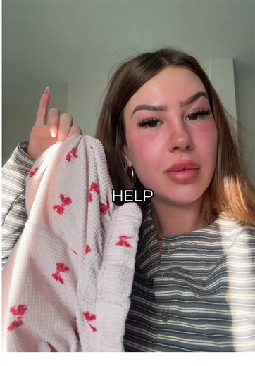 Sunburn Relief Tips Using Aloe Vera