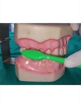 Modified Bass Brushing Technique