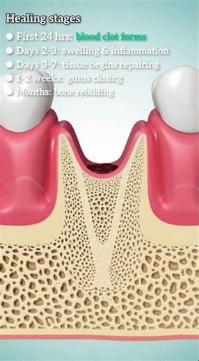 What happens after a tooth is pulled?