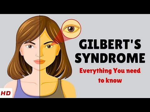 Gilbert's Syndrome – Causes, Signs and Symptoms, Diagnosis & Treatment