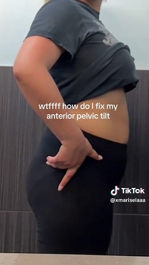 Understanding Anterior Pelvic Tilt and Its Impact