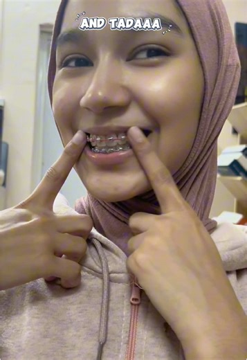 Steps I use to keep my braces clean everyday 🫶🏼❤️ #braces #bracescare #bracesjourney #adultbraces #oralhygiene #bracestips #cleaningbraces #bracescleaningroutine