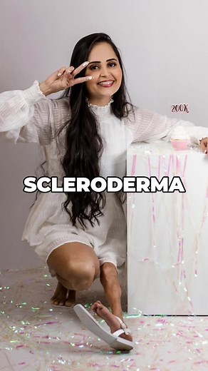 Understanding Scleroderma: Causes, Symptoms, and Treatment