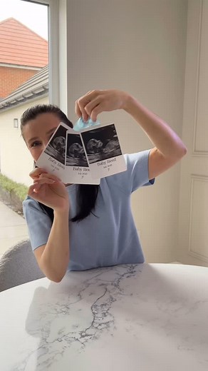 Baby Gender Announcement Bobos for members of the family 🤍🪄🥹🫶🏼💙🩵 DM to order a Balloon Gift for your next special occasion 📩 Next Day delivery across UK 📦🚚✅ baby scan balloon, pregnancy announcement gift, gender reveal balloon, baby announcement balloon, baby scan reveal idea, personalised baby balloon, baby shower surprise, unique pregnancy gift, new baby gift idea, ultrasound photo gift, pregnancy reveal keepsake, baby reveal balloon, special pregnancy surprise, custom baby scan gift