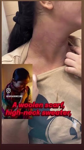 Winter Rash on Face & Neck? Don’t Ignore This | watch this before blaming products #drashimagoel