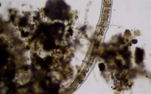 生物显微镜下观察水丝蚓(颤蚓)的外部形态及运动