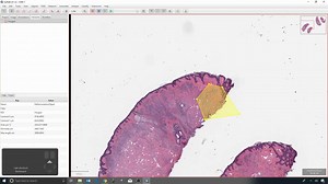 病理学切片开源处理软件QuPath官方教程 7 - Save and revert