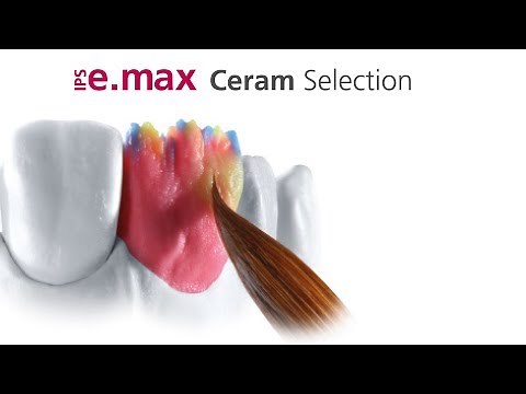 IPS e.max Ceram Selection