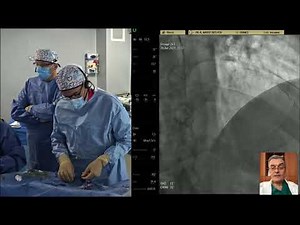 Complex bifurcation PCI: what to avoid? - EuroPCR 2021
