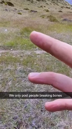 Watch People Break | Imagine if there was a page dedicated to people breaking bones... Music by: @gordoszn - LOCO LOCO #EpicFails #BreakingPoint #ExtremeAccidents | Instagram