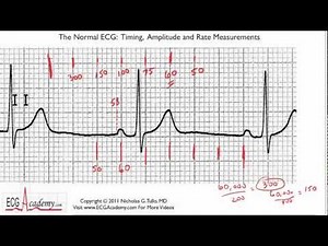ECG Interpretation, Determining Rate, Part 6-3 • Video • MEDtube.net