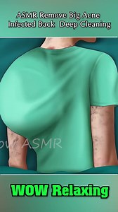 2.1M views · 10K reactions | #asmr #asmrsounds #animations #asmrtreatment #relaxing #asmrvideo #asmrremove | WOW Brain | Facebook