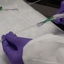 Video: A Mouse Model of Retinal Ischemia-Reperfusion Injury Through Elevation of Intraocular Pressure