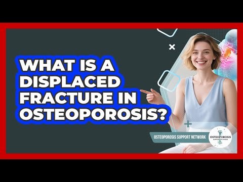 What Is A Displaced Fracture In Osteoporosis? - Osteoporosis Support Network