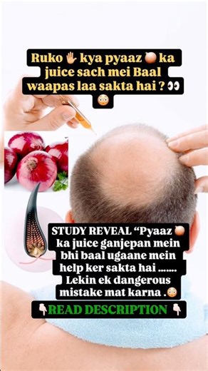 “Hair fall rokne ke liye log pyaz ka juice kyun laga rahe hain? 😳
