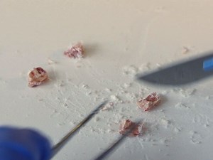 The Use of Reverse Phase Protein Arrays RPPA to Explore Protein Expression Variation within Individual Renal Cell Cancers