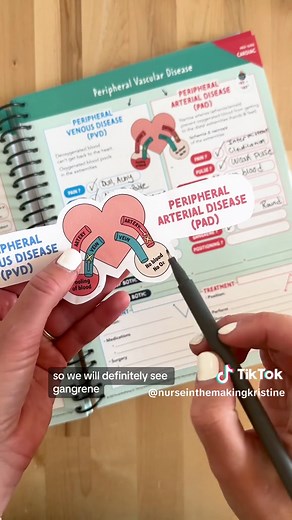 –Peripheral Vascular Diseases– 🔵PVD (Peripheral Venous Disease) vs. 🔴PAD (Peripheral Arterial Disease) 🔵PVD is a VENOUS (VEIN) issue, where the arterial blood is able to reach the lower extremities, but it cannot return to the heart, due to narrowed vessels. -S/S include: dull & achy pain, irregularly shaped wounds, edema (due to pooling of blood) -Remember, the blood can reach the extremities, but has a hard time circulation back UP, so elevation of legs is important, as well as aspirin or c