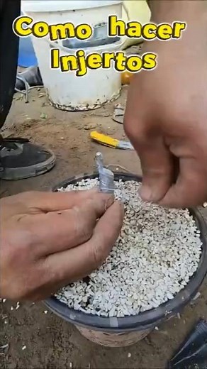 T-graft Step by Step! The Easiest Method