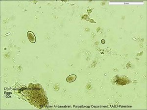 Diphyllobothrium latum Eggs Feces