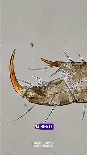 How do lice spread so quickly? #science #scientificfacts #facts #viralshort