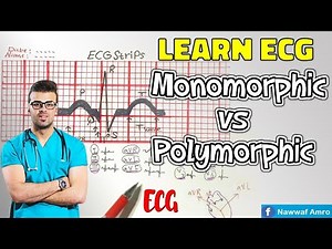 راجع معلوماتك و تعلم Ventricular Tachycardia (VT) (Monomorphic vs Polymorphic). Learn ECG