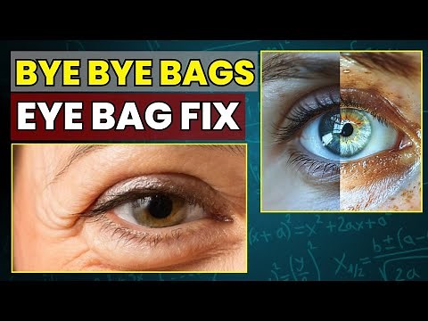Eye Doctor Explains How to Get Rid of Under EYE BAGS