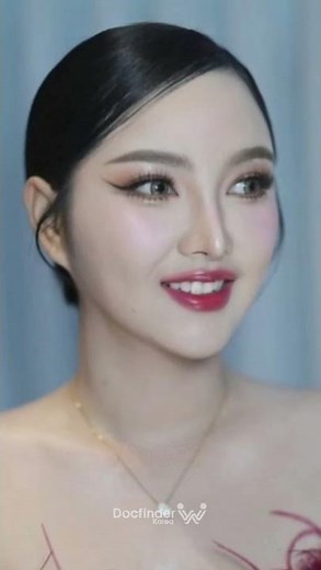My face became smaller in South Korea - Facial Contouring, Forehead Lift, Thread Lift Before & After