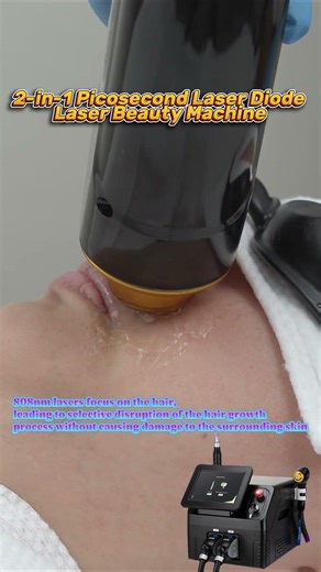 Upper Lip Hair Removal with Diode Laser | See It Up Close