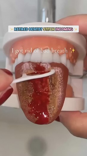 The Right Way To Clean Your Tongue 👅🙅 Follow for more expert tips to upgrade your oral hygiene routine! #dentist #dentistry #dentalcare #dentaladvice #dentisttips #dentistadvice #dentistrytips #dentistryadvice #dentaleducation #pediatricdentistry #dentalproducts #pediatricdentist #prophypaste #fluoridevarnish #toothpaste #fluoride #toothpastetips #healthyteeth #oralhealth #kidsdentist #dentaloffice #teethcleaning #dentalcleaning | Wonderful Dental