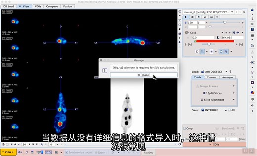 医学图像处理和分析软件 PMod（S1E9）：Isocontouring using a defined SUV threshold