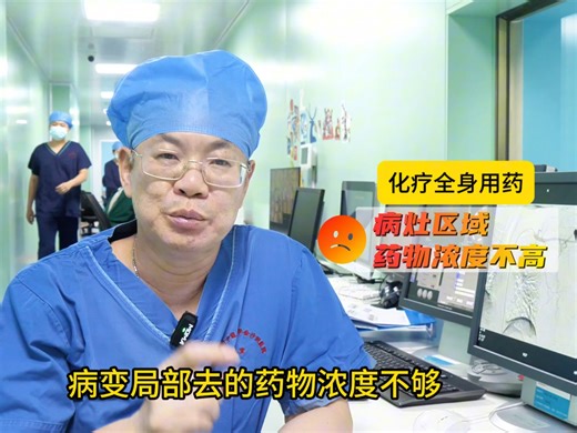 医生观点：肿瘤介入化疗灌注的用药量与疗效的问题如何考虑？