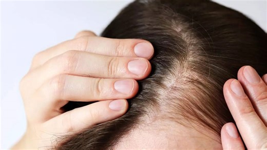 9 Signs of hormone imbalance on your face: Visible facial signs of oestrogen and testosterone decline