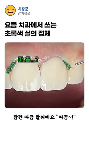 The true identity of the green thread used in dental clinics these days