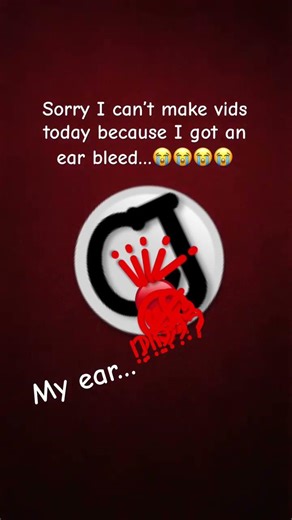 I got an ear bleed…