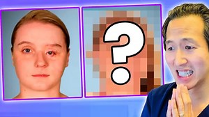 Botched: Extreme eye reconstruction