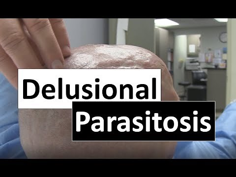 Delusional Parastosis