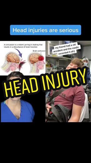 Recognizing Severe Head Injuries: Signs and Symptoms