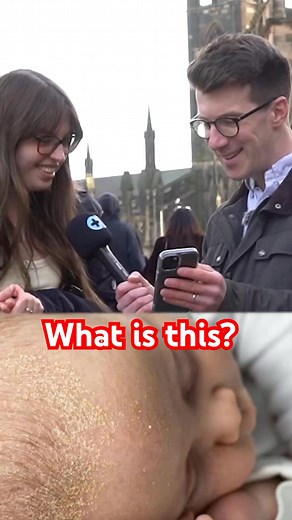 4.4K views | What is this dry scaly skin on a babies scalp ? #healthylifestyle #doctor #fblifestyle | Doctor O’Donovan | Facebook