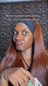 Pimple Extraction with Acne Patch: Gentle Pimple Pop Guide