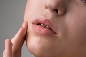 Struggling With Dry Lips Already? Here Are 6 Tips To Hydrate Them Naturally