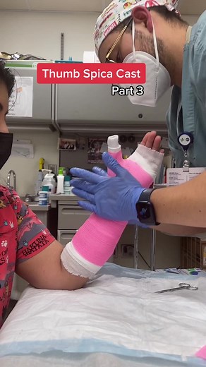 Long Arm Thumb Spica Cast Tutorial