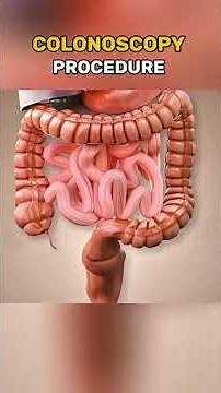 Colonoscopy Procedure Explained | 3D Medical Animation #Colonoscopy #GutHealth