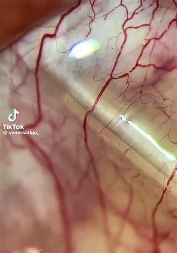 video de eritrocitos en movimiento