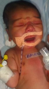 NEW BORN BABY BEING STEAMED AT NICU 💯🥰 #fbreelsfypシ゚viralvideo #fbreelsfypシ゚viralシ #fypシ゚viralシfypシ゚ #fbreelsfypシ゚vir #fbreelsfypシ゚viralv #shortsreels #videoviralシ #foryoupagereels #facebookreelsviral | The Navjat Shishu Sansar